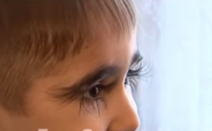 Dječaku trepavice duge više od 4 cm i to mu nimalo ne smeta